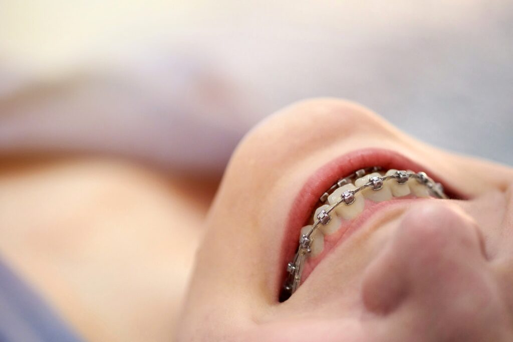 Smiling girl with braces close up.